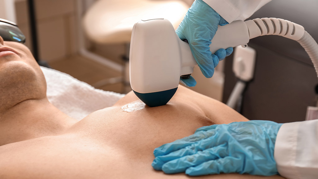 Medicina estetica per gli uomini: i trattamenti più richiesti