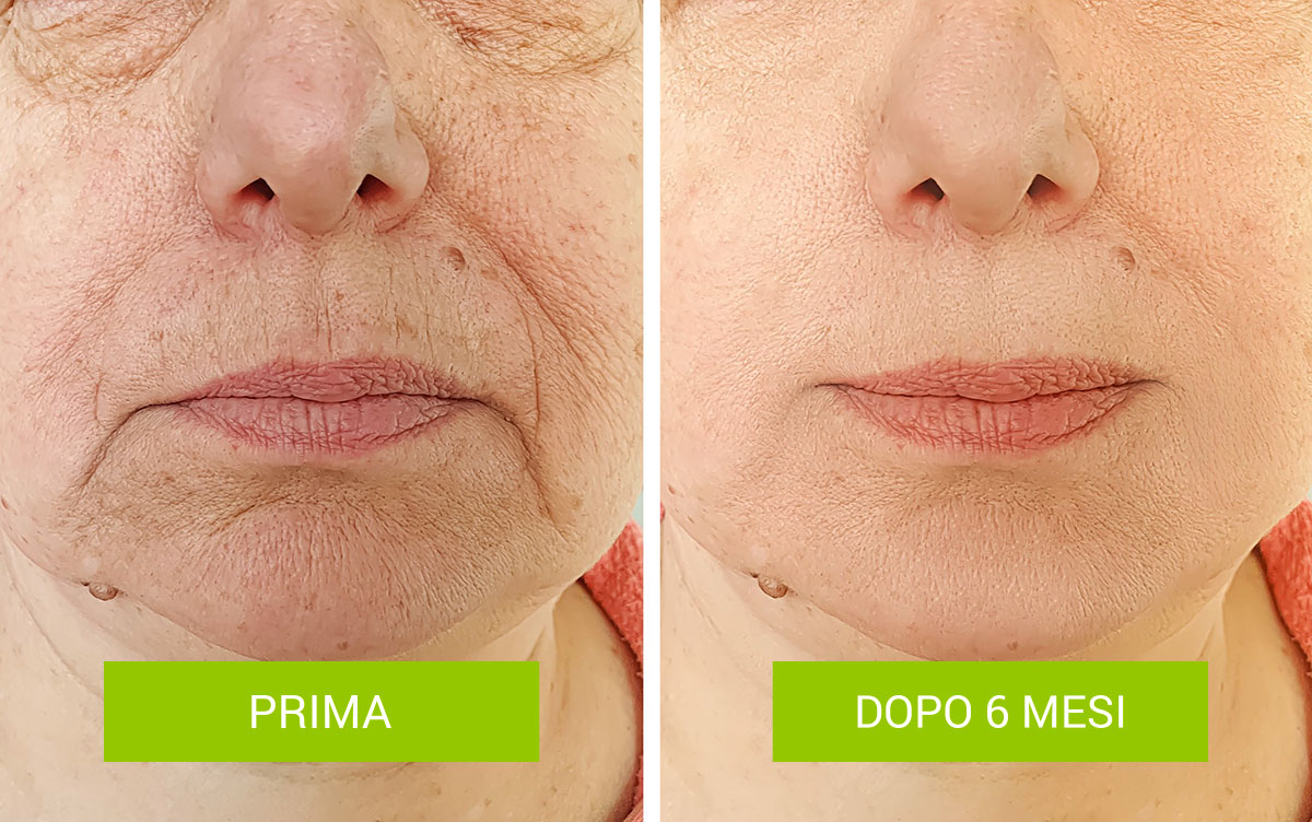 prima-dopo-1-1