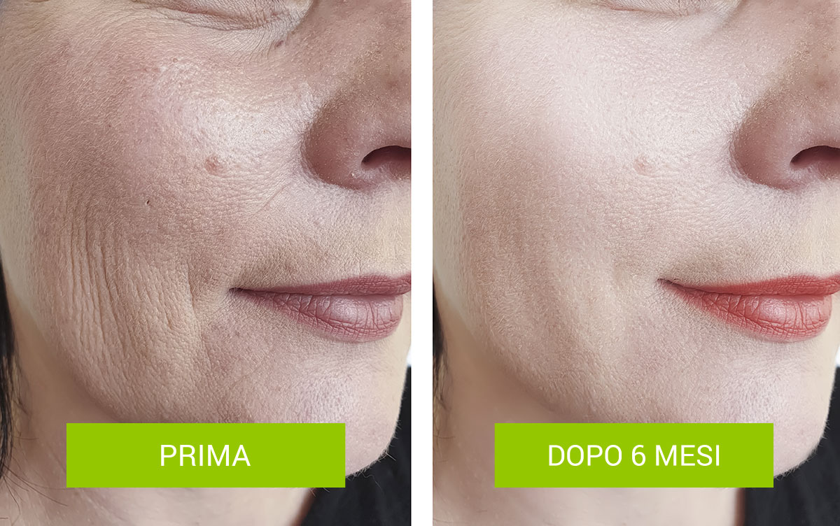 prima-dopo-2-1