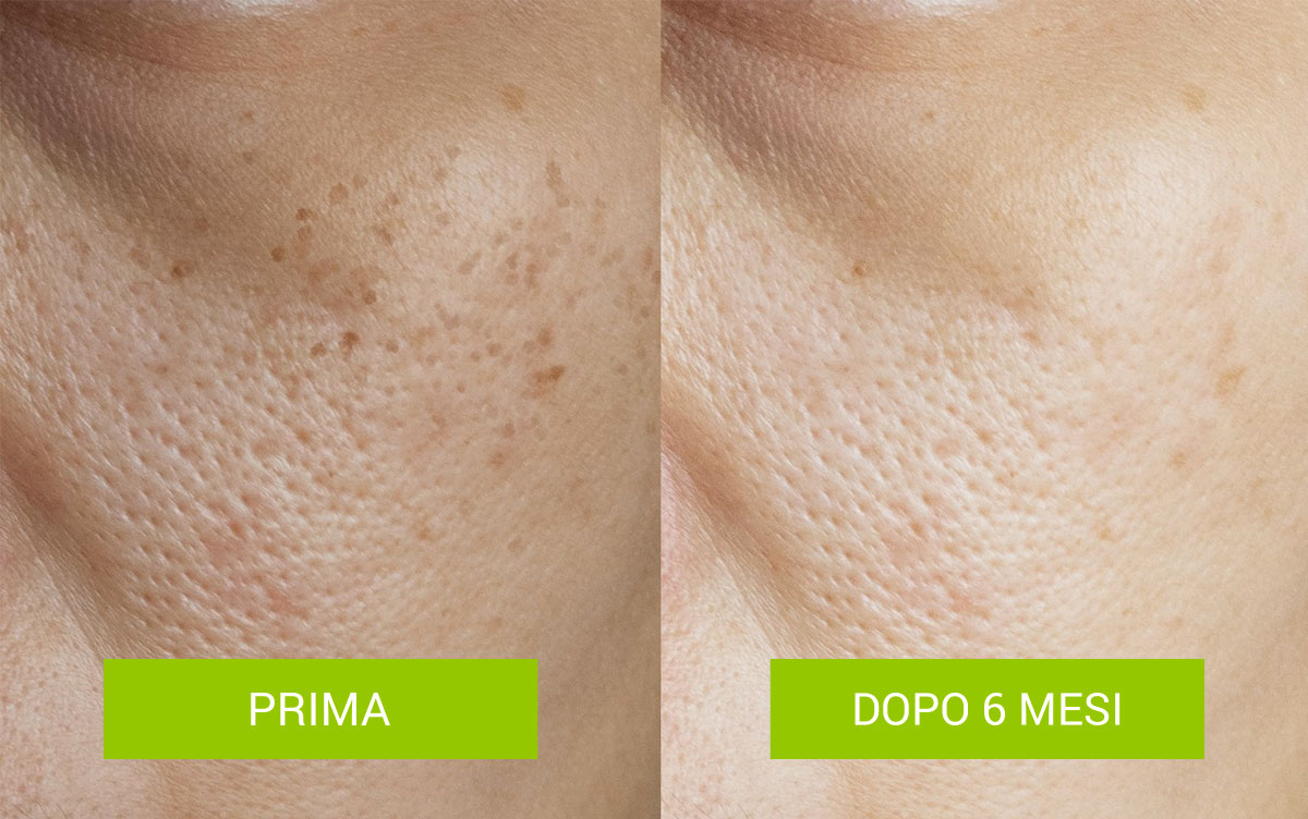 prima-dopo-3-2